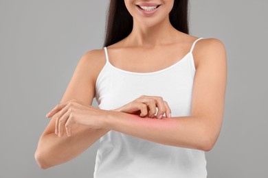 Photo of Young woman scratching her arm on light grey background, closeup