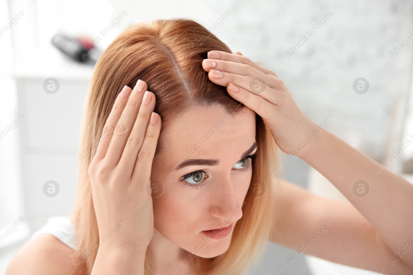 Photo of Young woman with hair loss problem at home