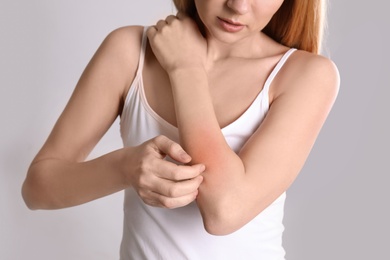 Woman with allergy symptoms scratching forearm on grey background, closeup