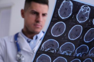 Photo of Doctor examining MRI images of patient with multiple sclerosis in clinic, closeup