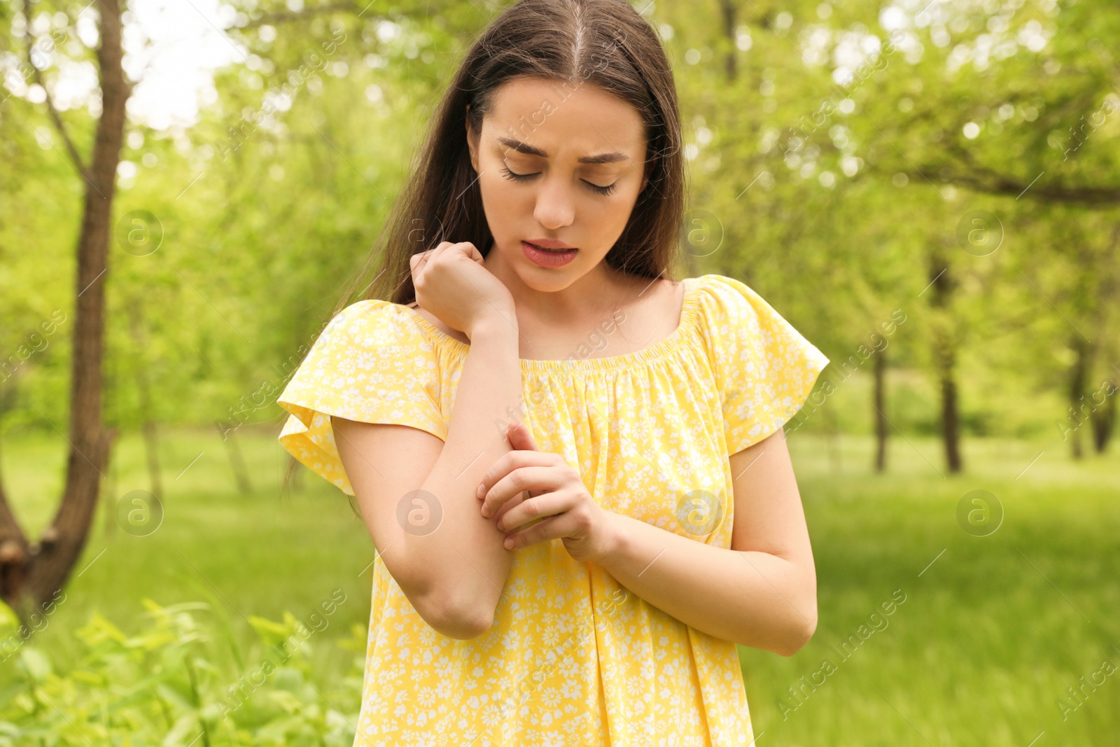 Photo of Young woman scratching hand outdoors. Seasonal allergy