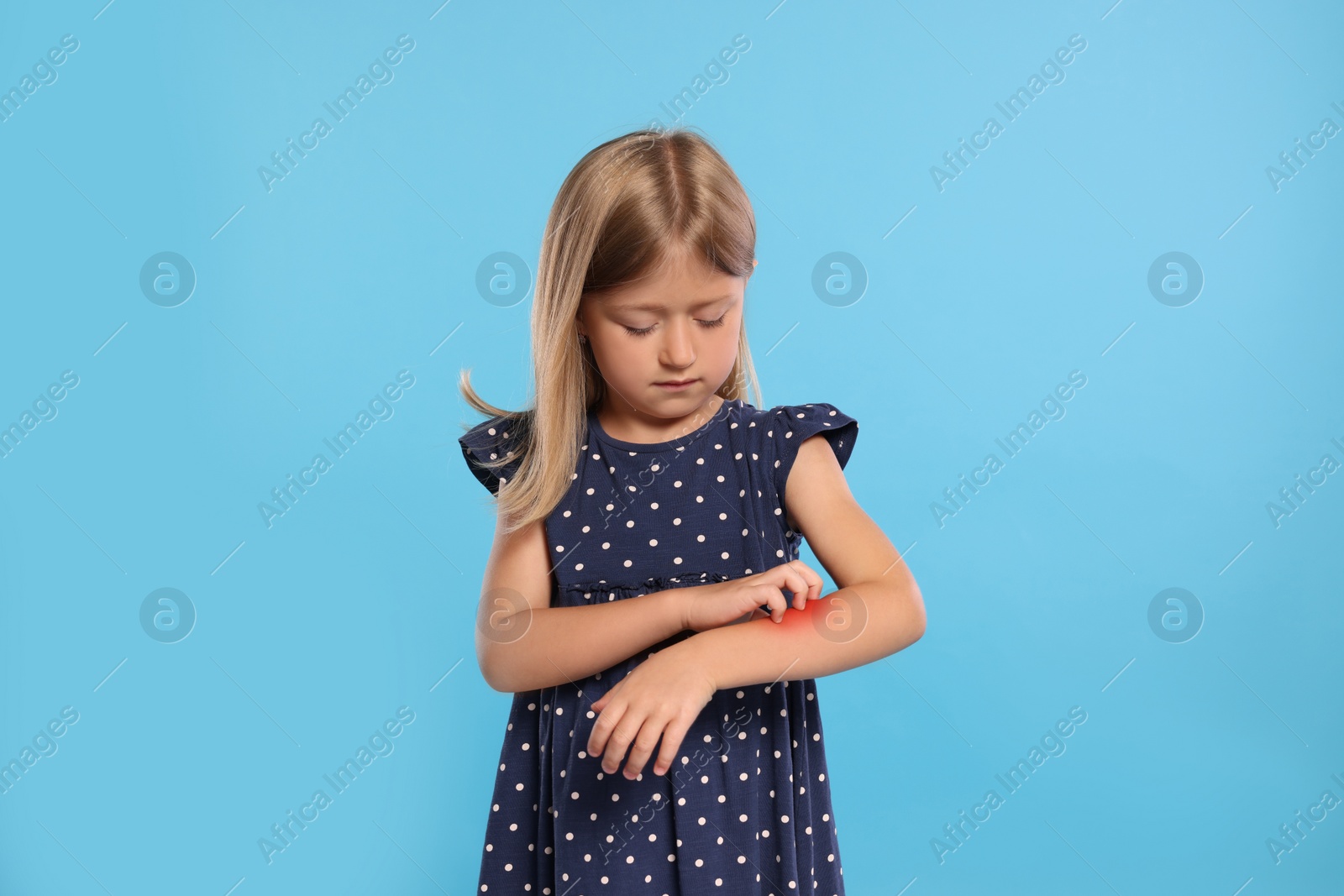 Photo of Suffering from allergy. Little girl scratching her arm on light blue background