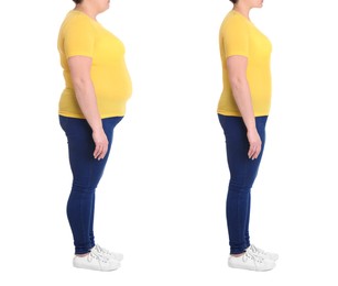 Image of Collage with photos of woman before and after weight loss diet on white background 