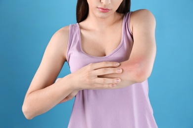 Photo of Young woman scratching hand on color background, closeup. Allergies symptoms