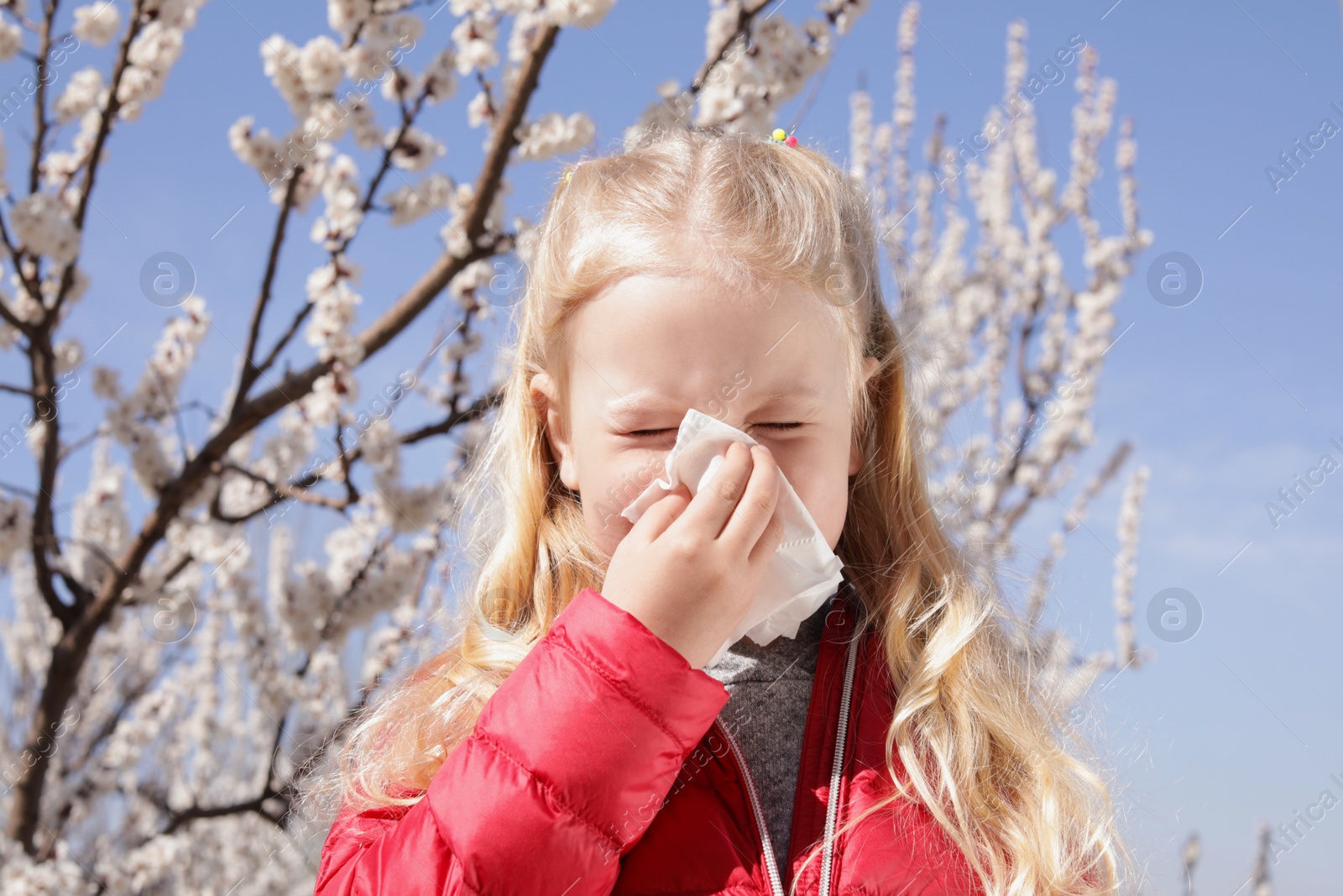 Photo of Little girl suffering from seasonal allergy outdoors