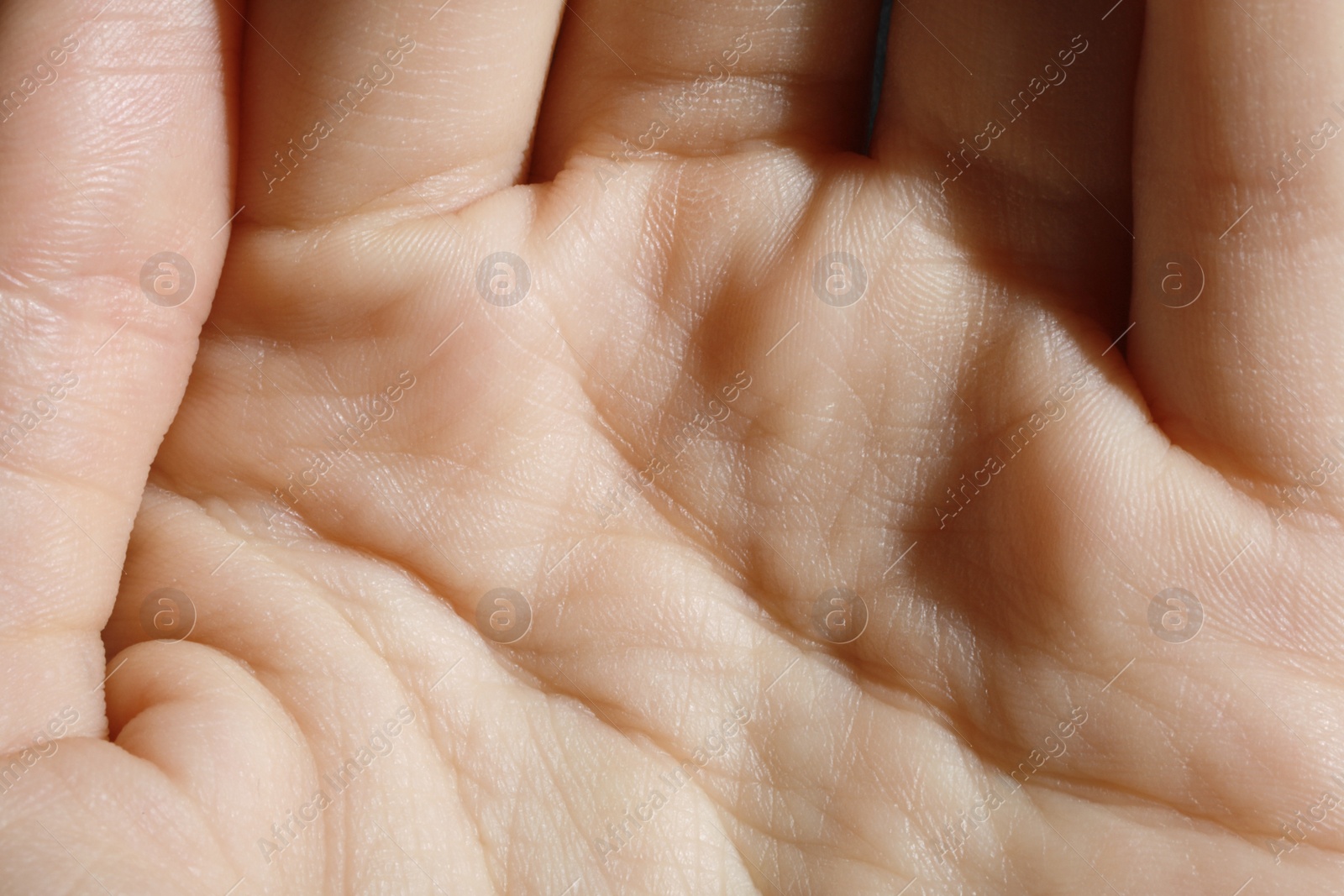 Photo of Closeup view of human hand with dry skin