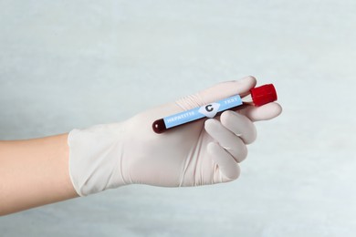 Scientist holding tube with blood sample and label Hepatitis C test on light background, closeup