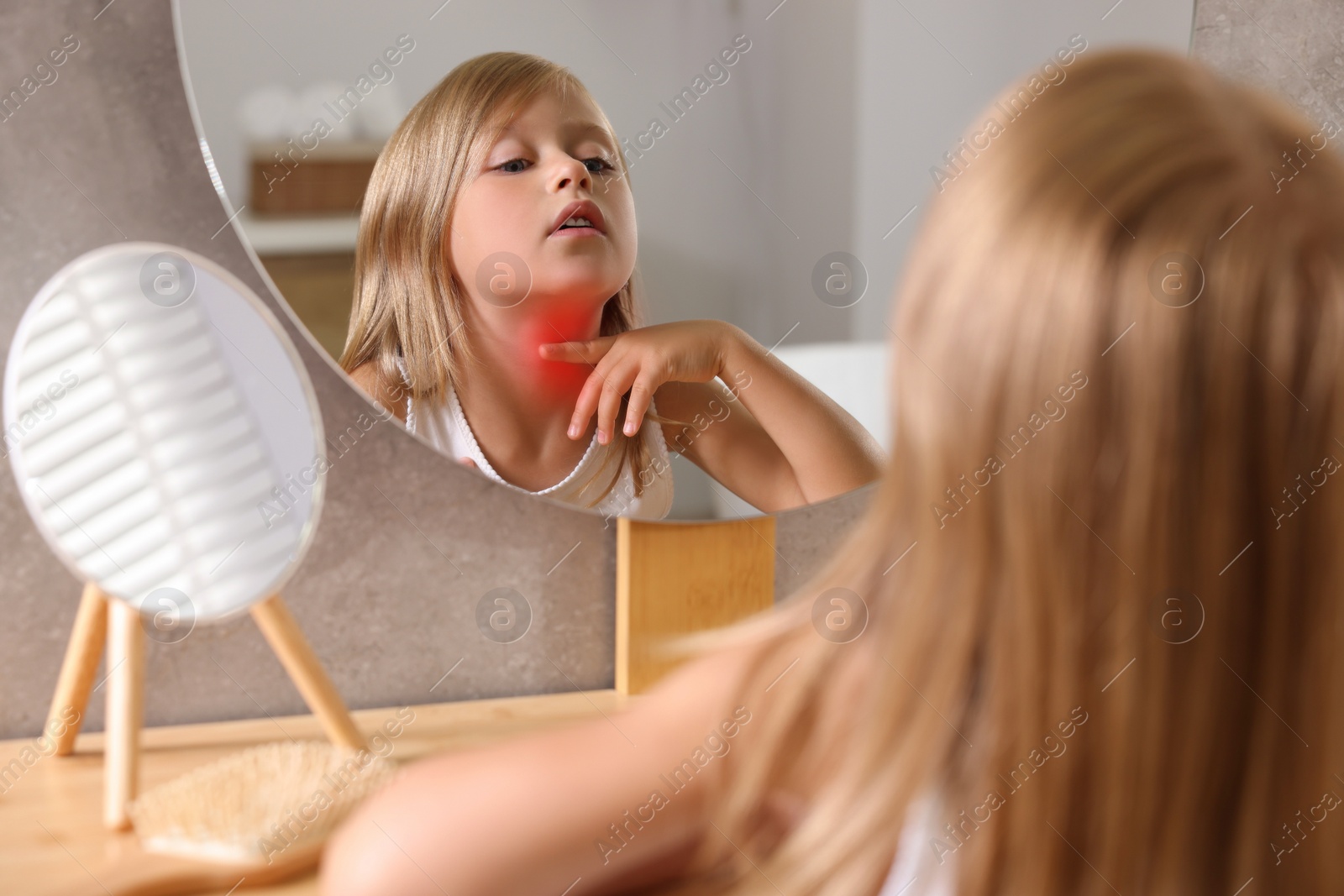 Photo of Suffering from allergy. Little girl looking in mirror and scratching her neck at home