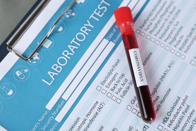 Photo of Test tube with blood sample and label CORONAVIRUS on table, closeup