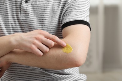 Photo of Man applying yellow ointment onto arm indoors, closeup