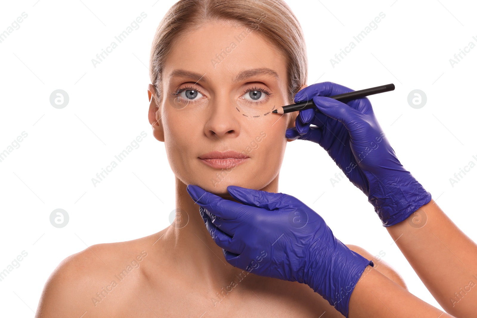 Photo of Doctor with pencil preparing patient for cosmetic surgery operation on white background, closeup