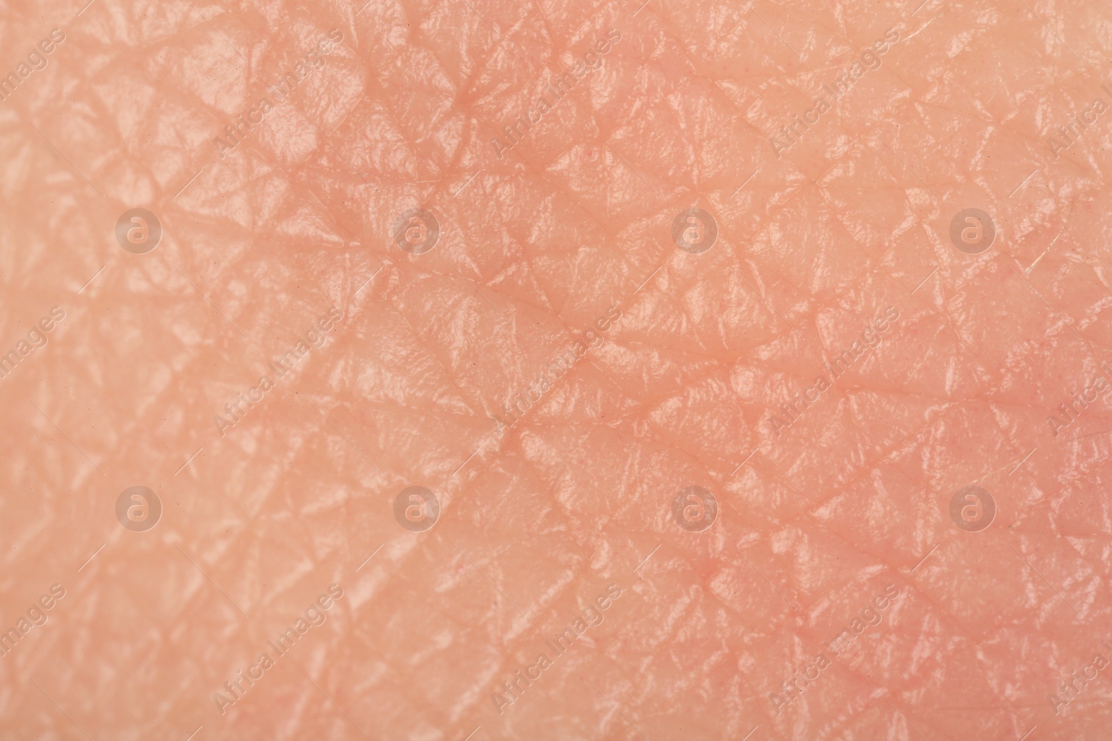 Photo of Texture of healthy skin as background, macro view