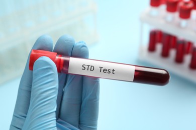 Photo of Scientist holding tube with blood sample and label STD Test on light blue background, closeup