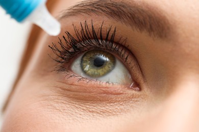 Photo of Woman applying medical eye drops, macro view