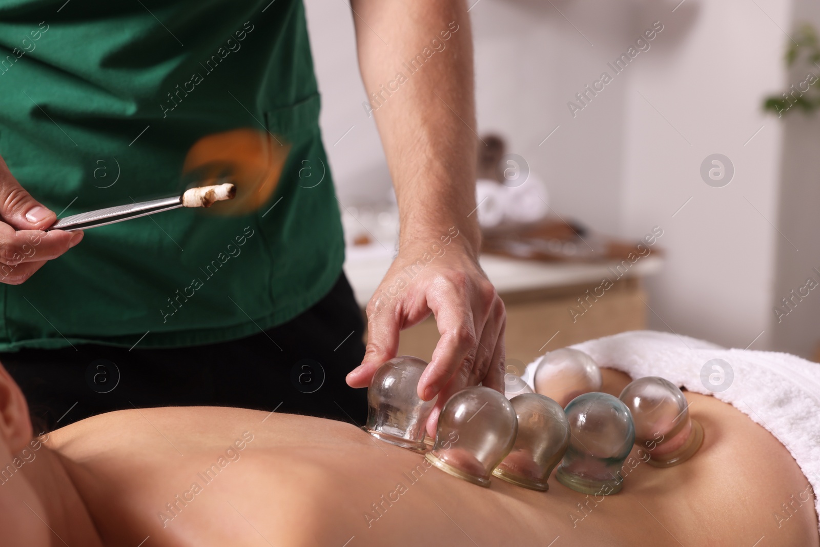 Photo of Therapist giving fire cupping treatment to patient indoors, closeup