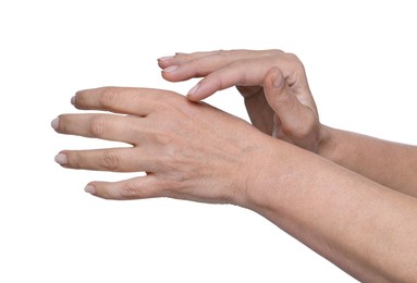 Closeup of woman's hands with aging skin on white background. Rejuvenation treatment