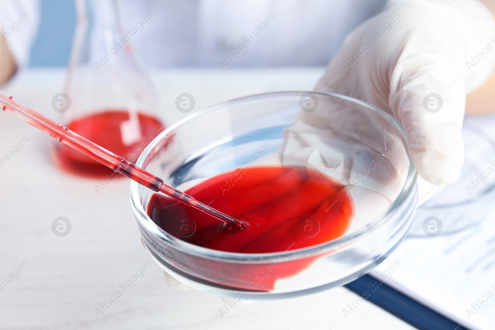 Photo of Scientist taking blood sample from Petri dish with pipette in laboratory, closeup. Virus research