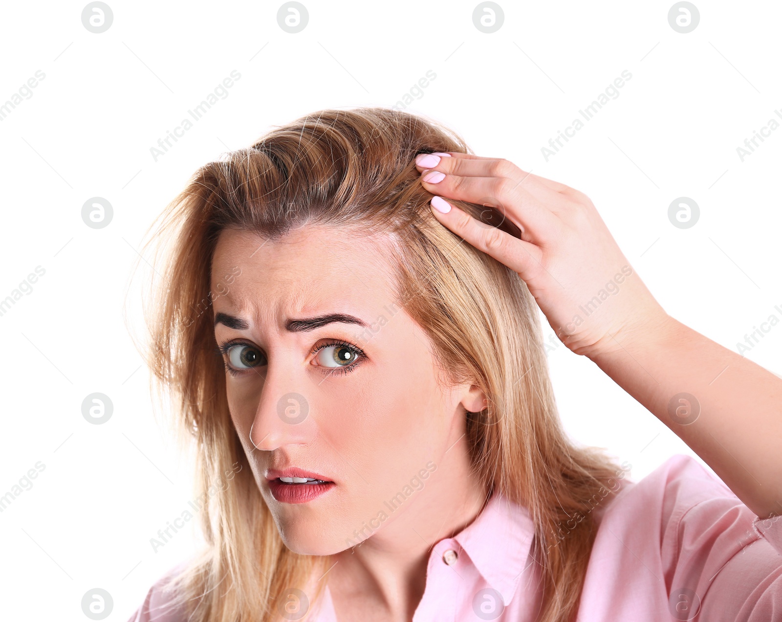 Photo of Young woman with hair loss problem on white background