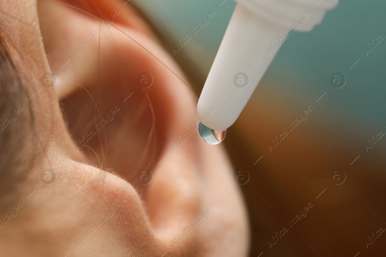 Photo of Woman applying medical ear drops, macro view