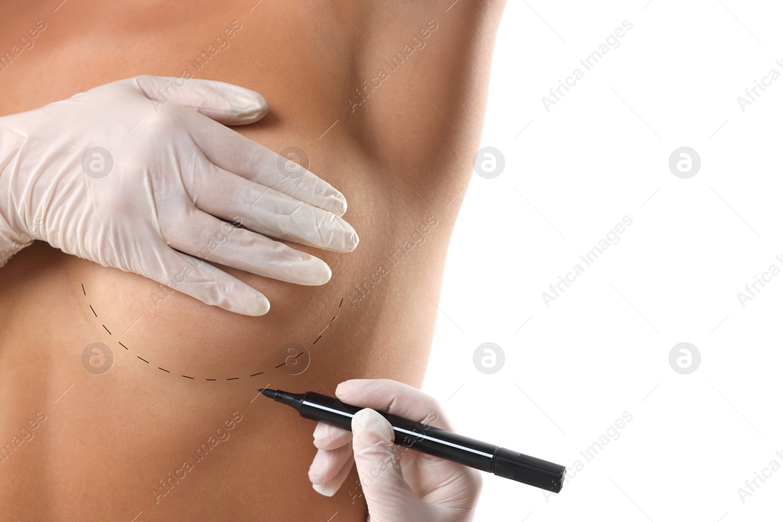 Image of Breast augmentation. Doctor with marker preparing woman for plastic surgery operation against white background, closeup