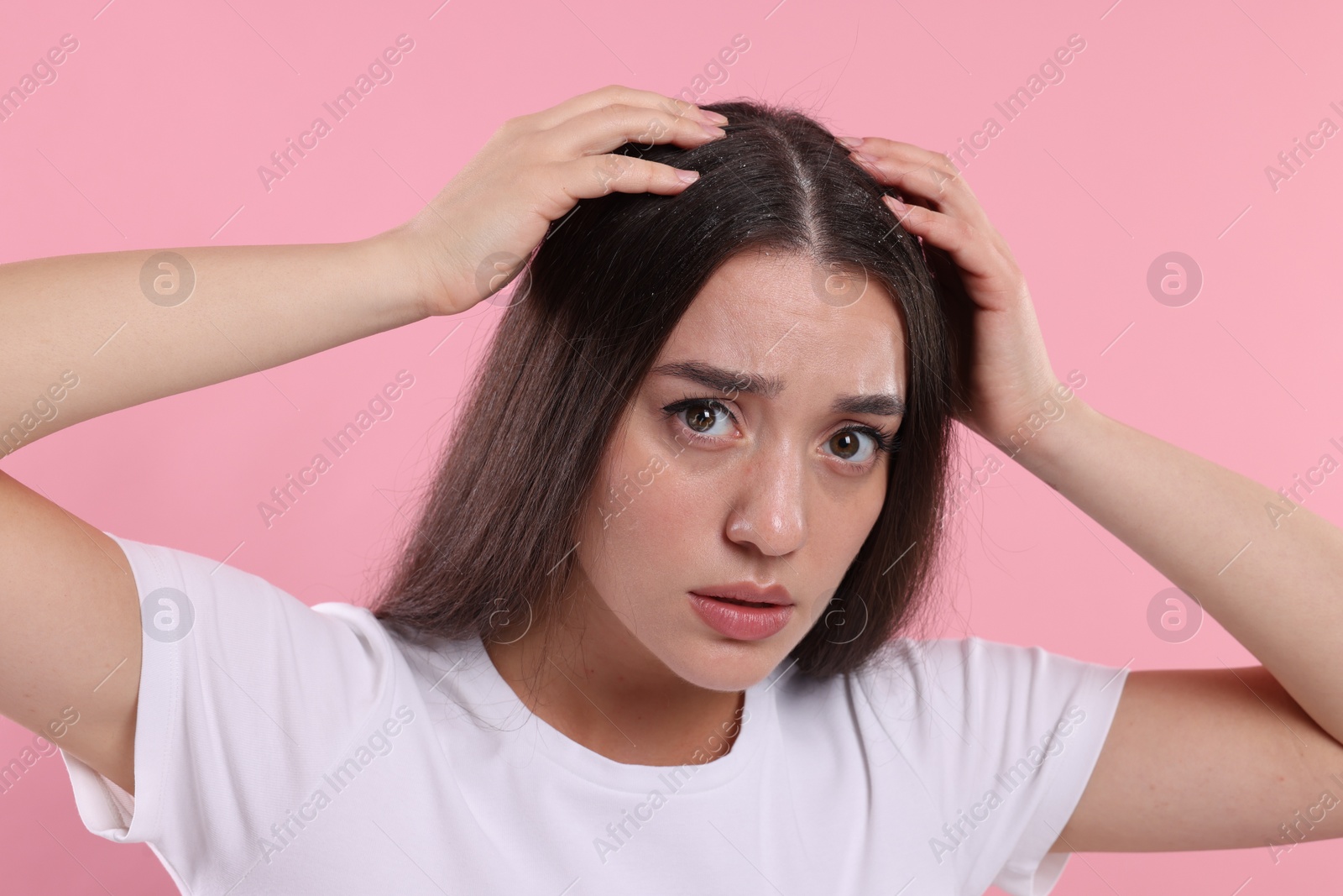 Photo of Emotional woman suffering from dandruff problem on pink background