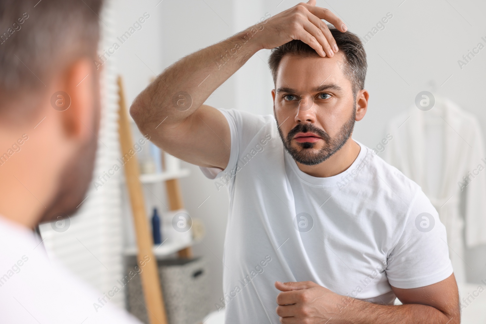 Photo of Confused man with skin problem looking at mirror indoors