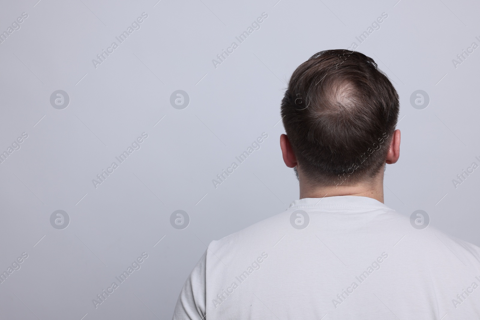 Photo of Baldness concept. Man with bald spot on light grey background, back view. Space for text