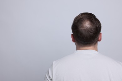 Photo of Baldness concept. Man with bald spot on light grey background, back view. Space for text