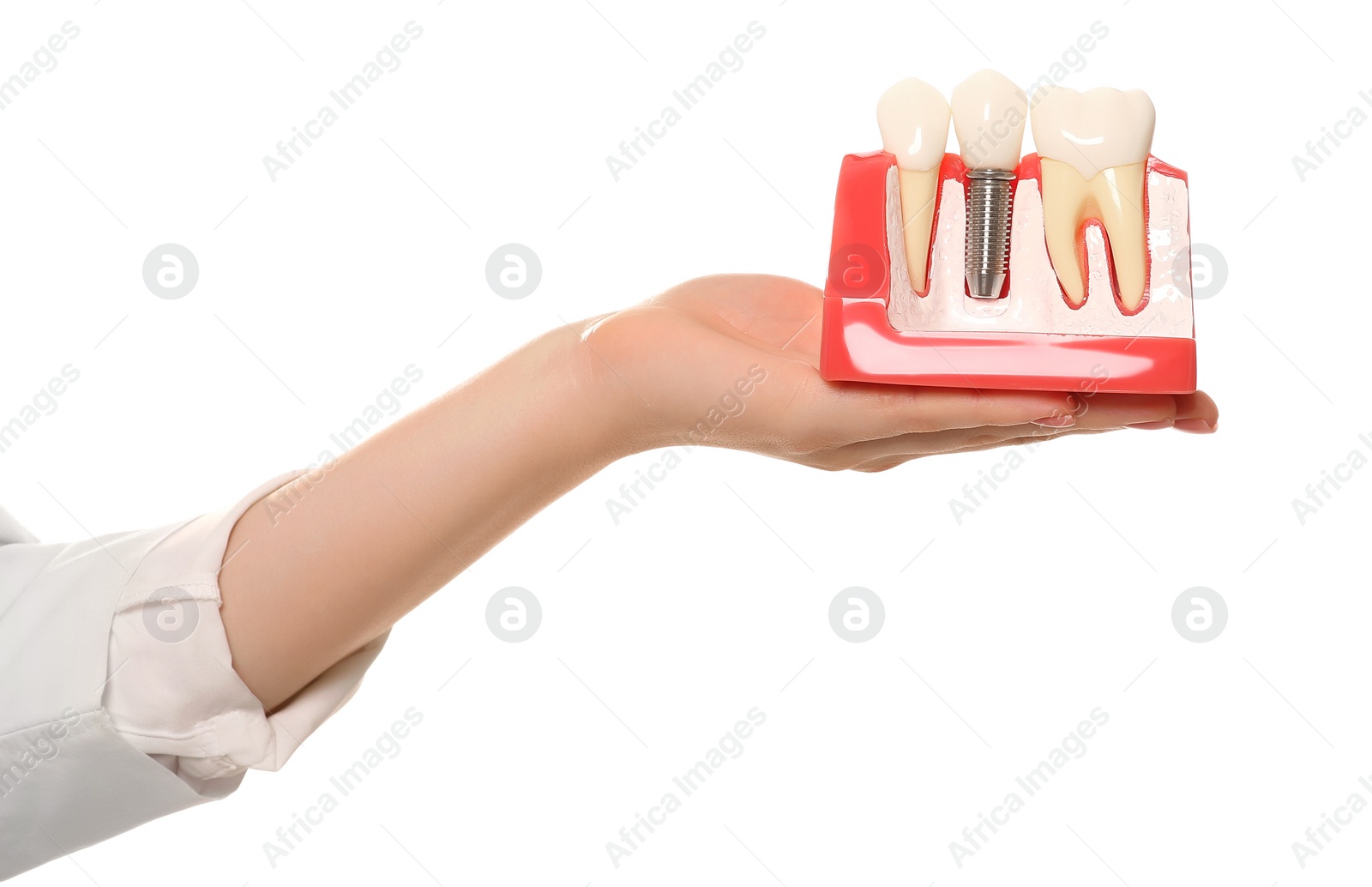 Photo of Dentist holding educational model of dental implant on white background, closeup