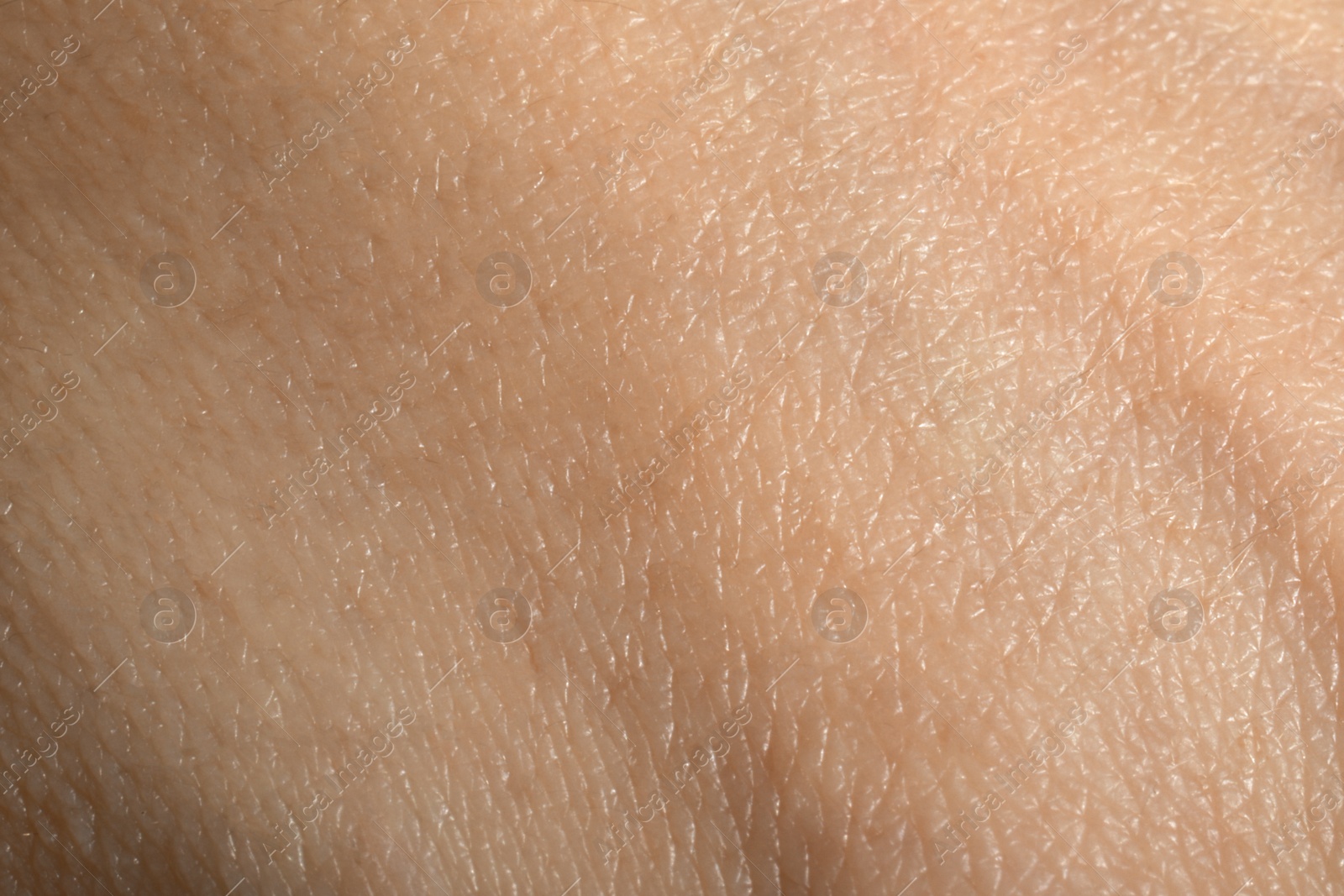 Photo of Closeup view of dry human skin as background