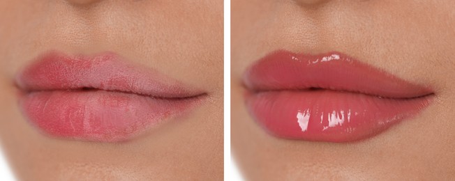 Image of Collage with photos of woman with dry and moisturized lips, closeup. Banner design