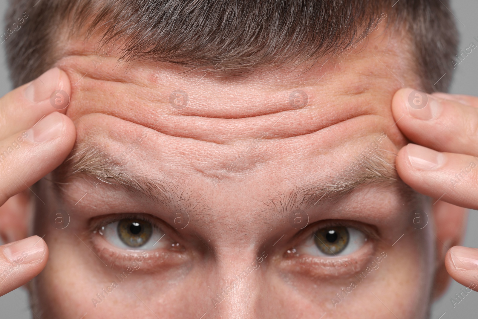 Photo of Closeup view of man with wrinkles on his forehead