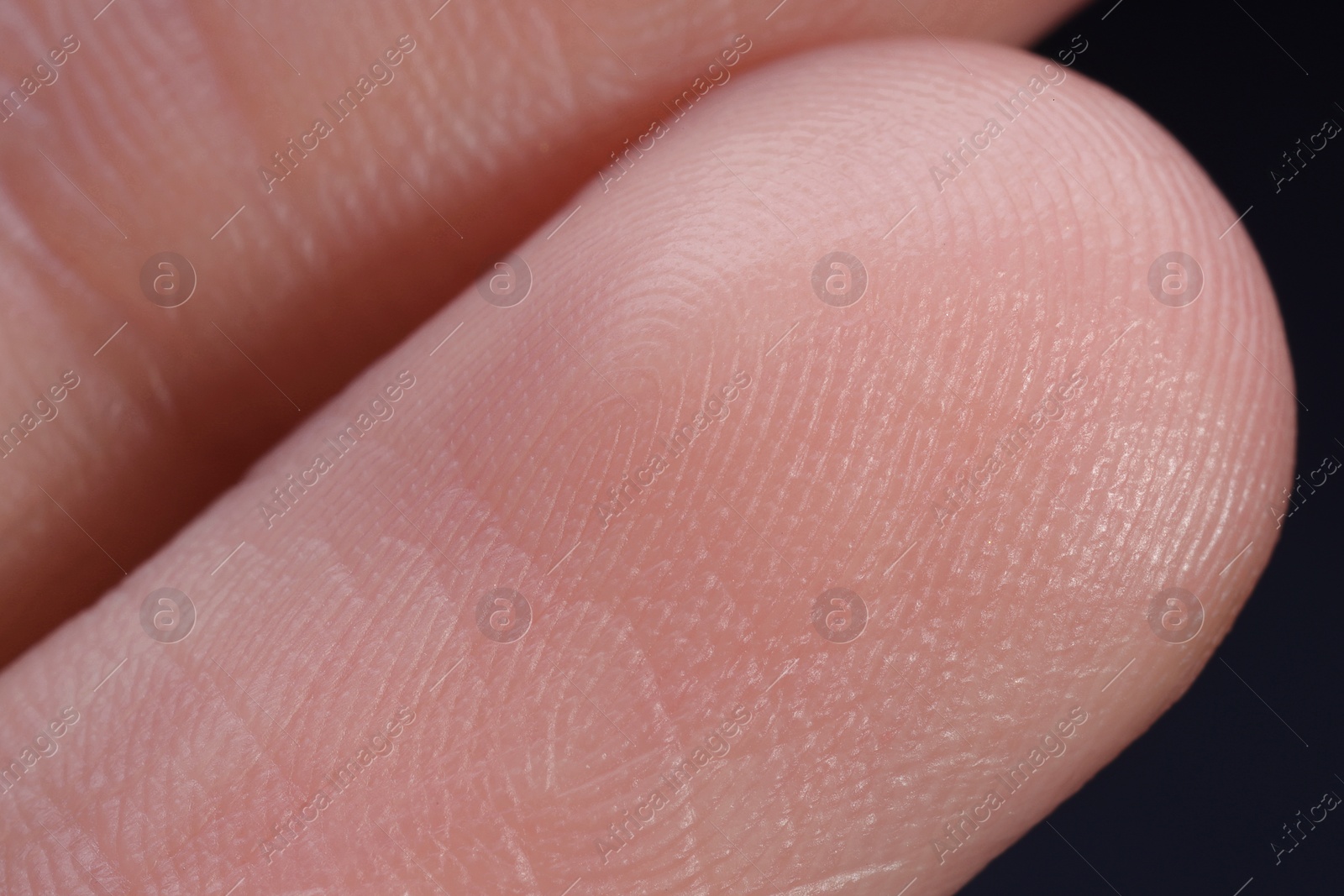 Photo of Macro view of finger with friction ridges