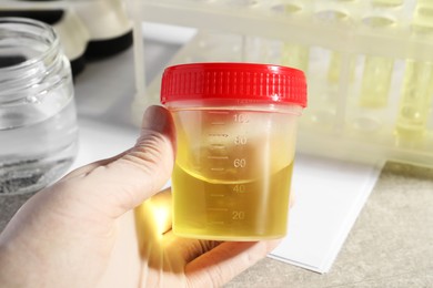 Photo of Doctor holding container with urine sample for analysis at grey table, closeup