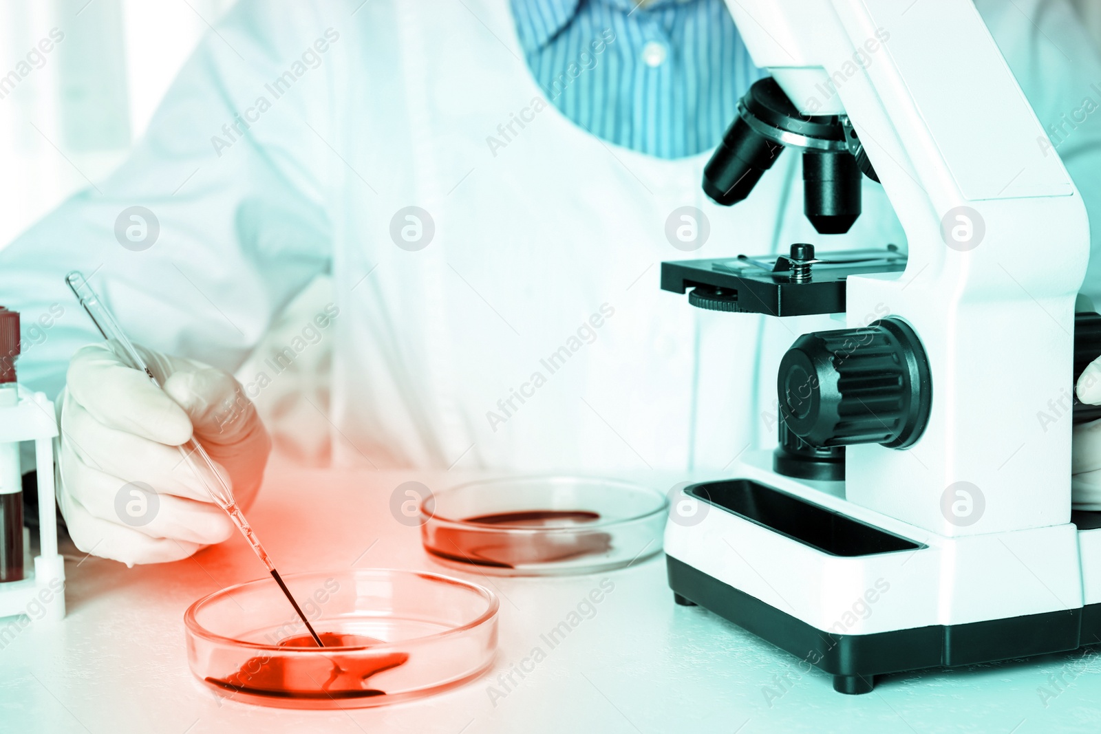 Image of Scientist examining blood sample with microscope, closeup. Laboratory analysis