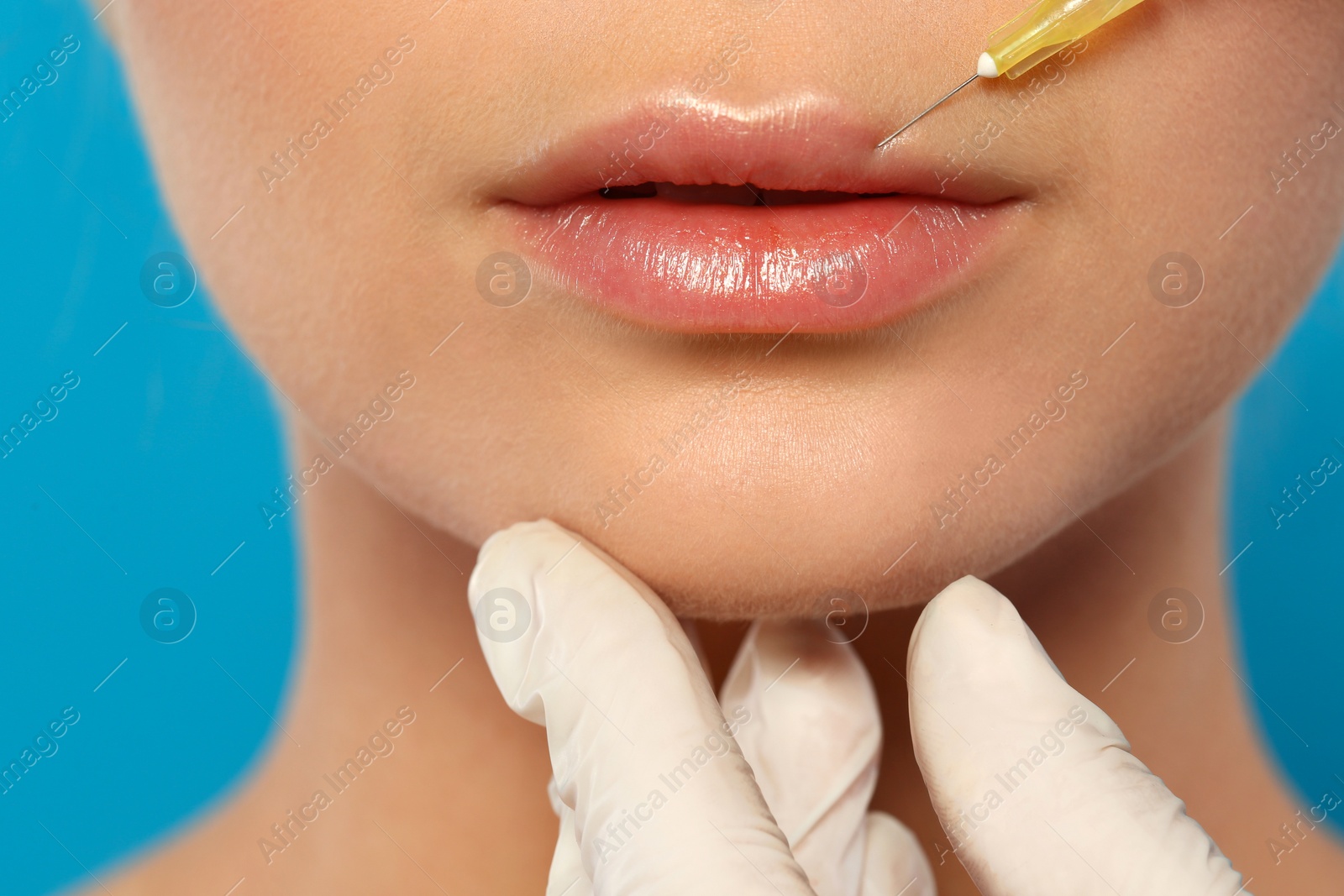 Photo of Young woman getting lips injection on color background, closeup. Cosmetic surgery