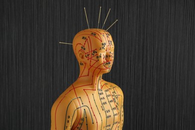 Photo of Acupuncture - alternative medicine. Human model with needles in head against black background