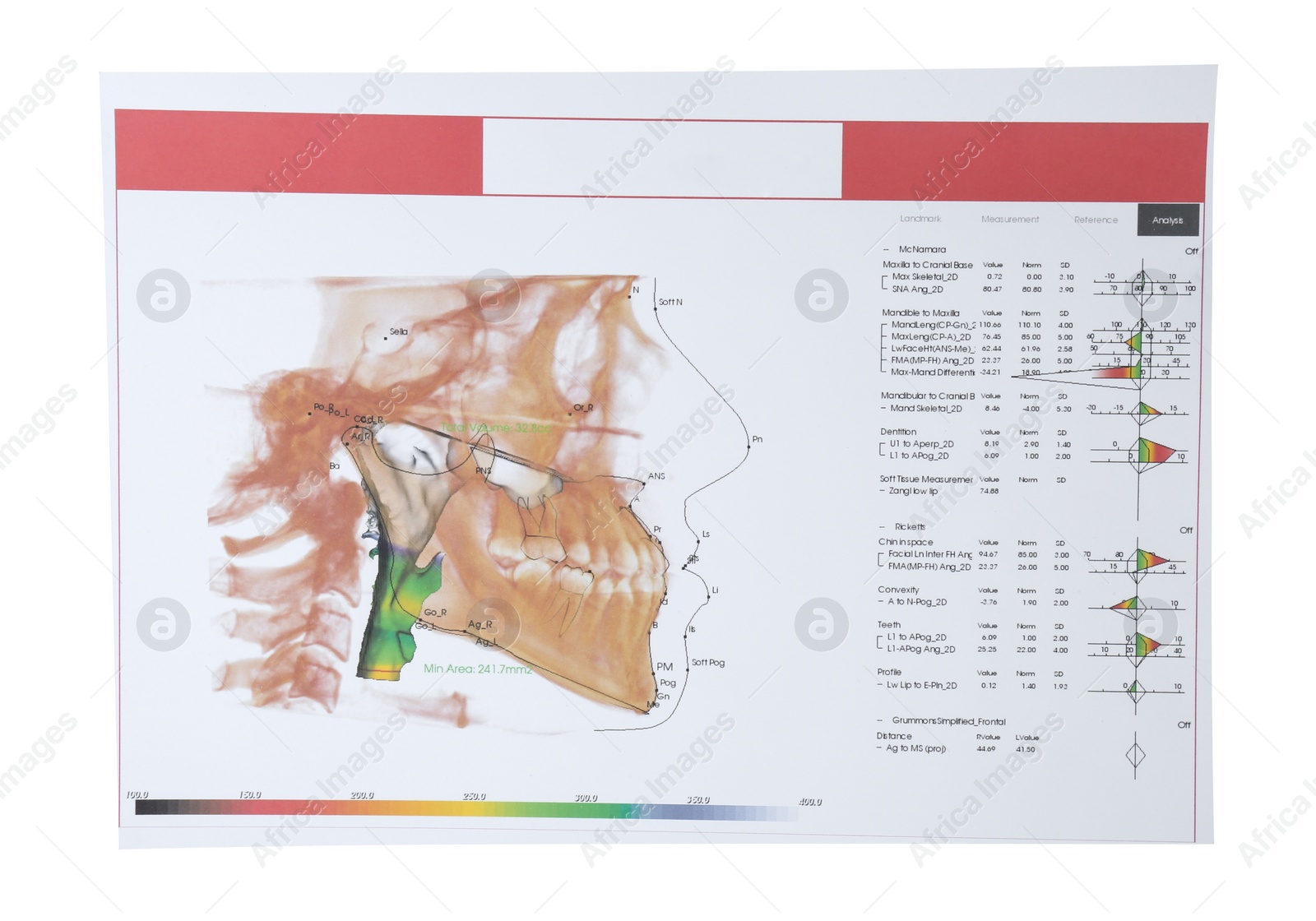 Photo of Visualization of human maxillofacial section for dental analysis printed on paper isolated on white