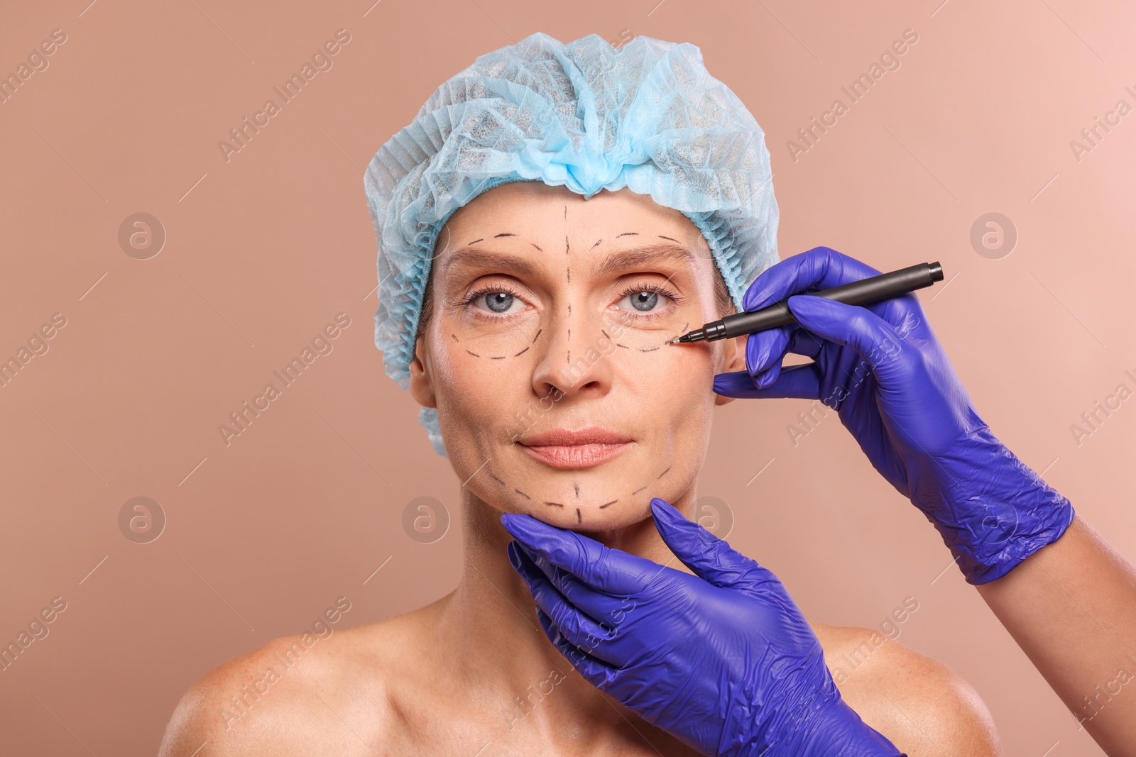 Photo of Doctor with marker preparing patient for cosmetic surgery operation on light brown background