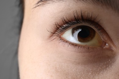 Photo of Woman with yellow eyes on grey background, closeup. Symptom of hepatitis