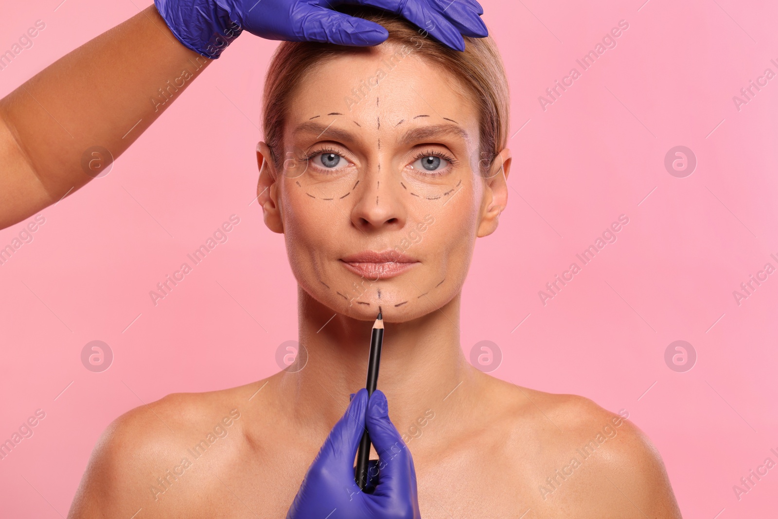 Photo of Doctor with pencil preparing patient for cosmetic surgery operation on pink background, closeup