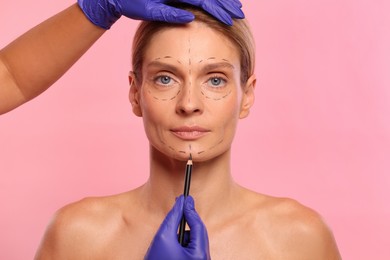 Doctor with pencil preparing patient for cosmetic surgery operation on pink background, closeup