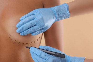 Image of Breast augmentation. Doctor with marker preparing woman for plastic surgery operation against beige background, closeup