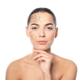 Image of Beautiful young woman with dry skin on white background