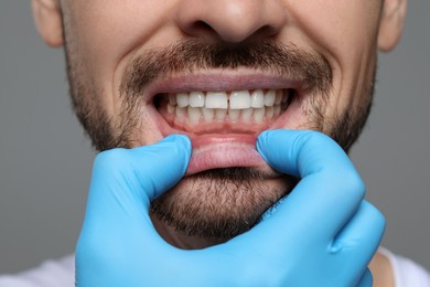 Photo of Man showing healthy gums on gray background, closeup