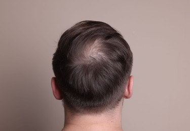 Photo of Baldness concept. Man with bald spot on beige background, back view