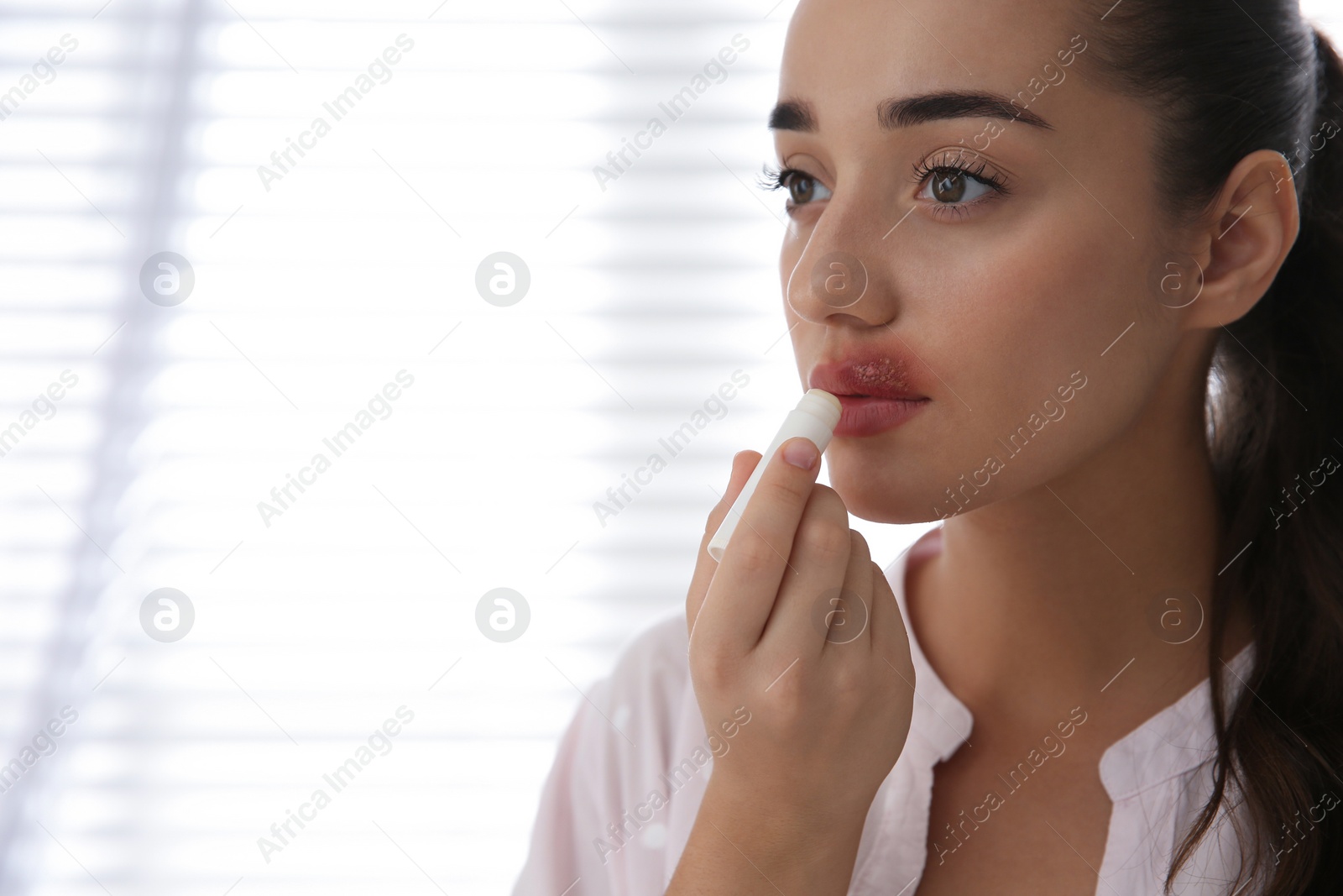 Photo of Young woman with herpes applying lip balm against light background. Space for text