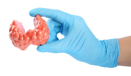 Photo of Doctor holding plastic model of afflicted thyroid on white background, closeup