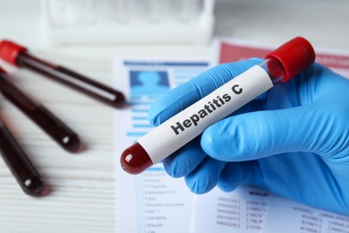 Scientist holding tube with blood sample and label Hepatitis C near laboratory test form, closeup
