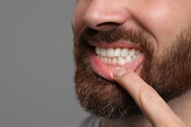 Photo of Man showing healthy gums on gray background, closeup. Space for text